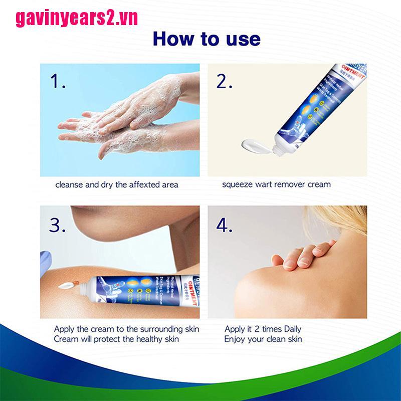 [GAV2]Wart Remover Cream Skin Tag Remover for Warts Skin Tag Plantar Warts Corn