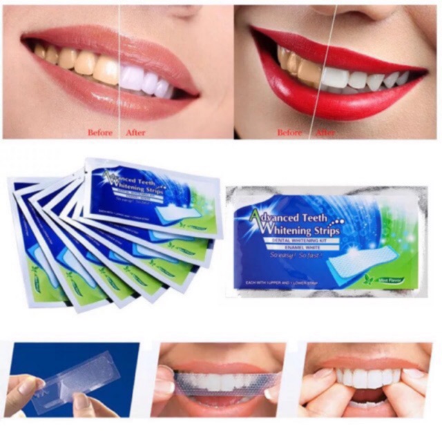 1 hộp 14 gói- 28 Miếng dán trắng răng chính hãng Mỹ- Advanced Teeth Whitening Strips