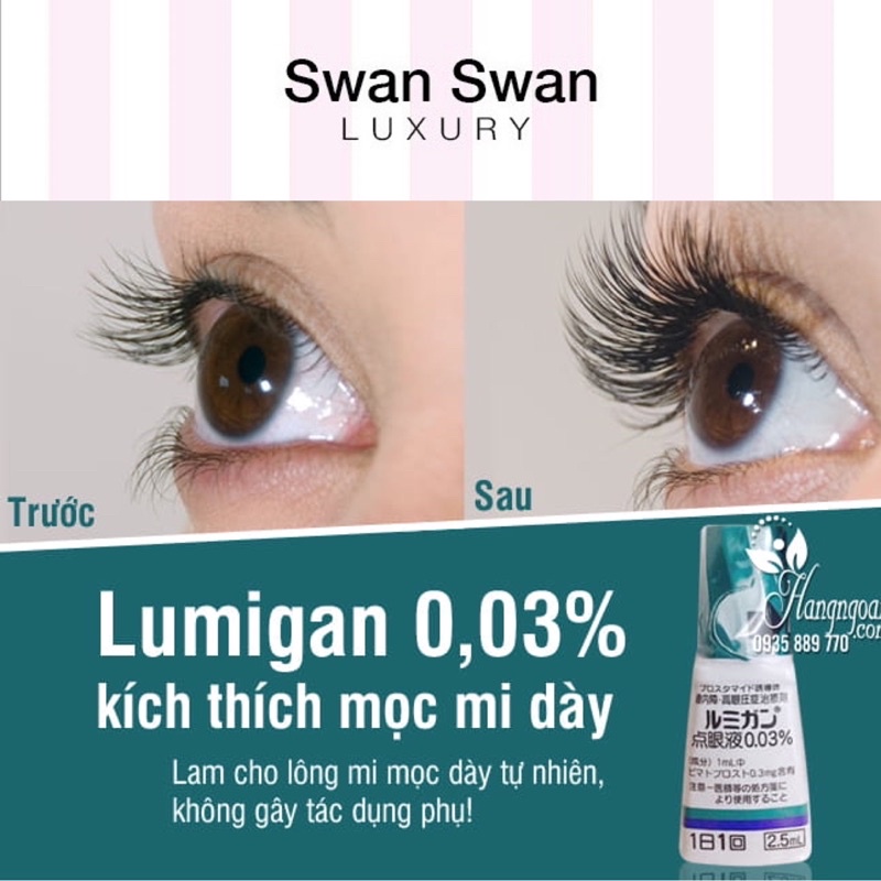 Tinh Chất Dài Mi Nhật Bản Lumigan 0,01% 5ml