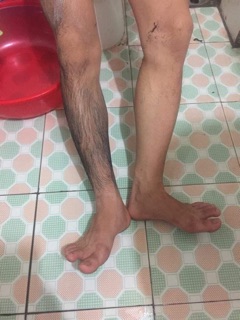 Gel tẩy lông Mamenshop