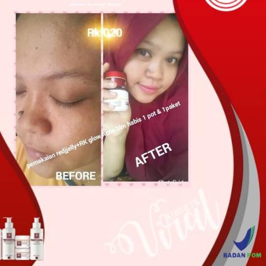 Il30b9 Thạch Đỏ.,!! | BigBuy360 - bigbuy360.vn