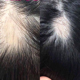 😊BÔI KÍCH THÍCH MỌC TÓC THẢO DƯỢC SATO NHẬT BẢN