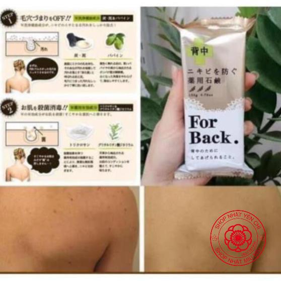 Xà phòng mụn lưng Forback (For back) Nhật Bản