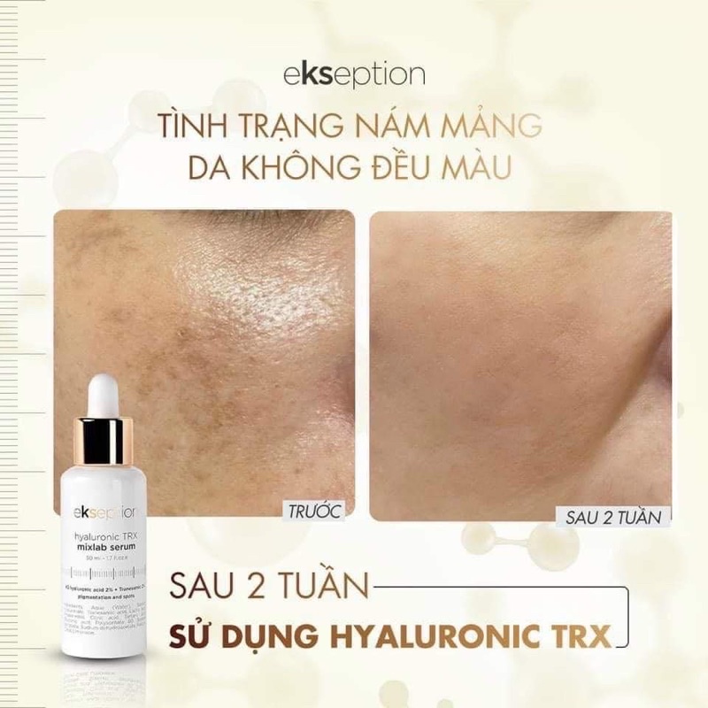 Serum cho da sạm nám Ekseption Hyaluronic