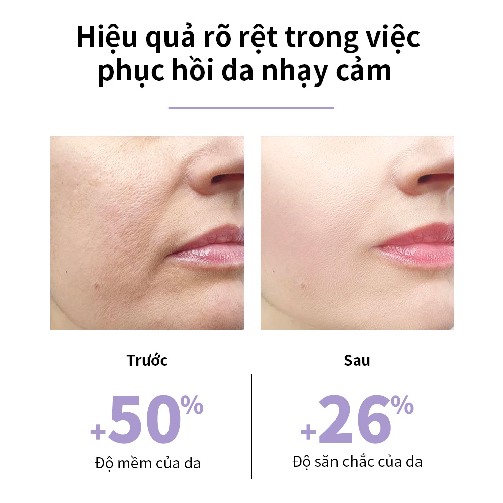 Kem dưỡng ẩm làm dịu LANBENA Phục hồi da Giảm ửng đỏ khô ngứa Dành cho da nhạy cảm