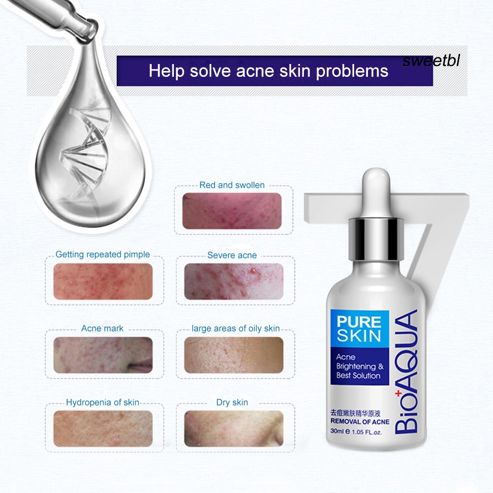 Tinh Chất Bioaqua Ngừa Mụn Kiểm Soát Dầu Dưỡng Ẩm Hiệu Quả 30ml | BigBuy360 - bigbuy360.vn