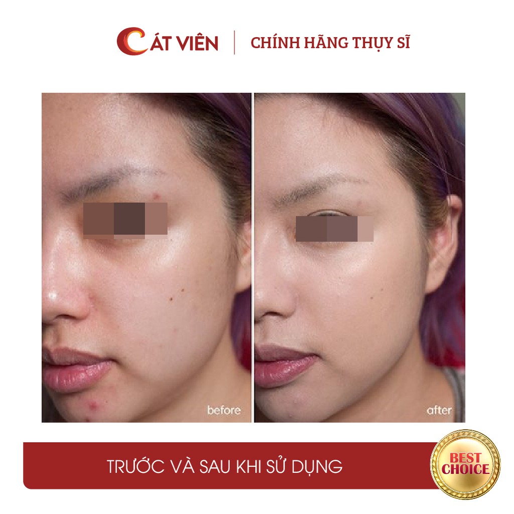 Serum dưỡng trắng HYDRO B5 Derma, dưỡng ẩm, kiềm dầu, se khít lỗ chân lông, cải thiện da mụn Me’dream 100ml | BigBuy360 - bigbuy360.vn