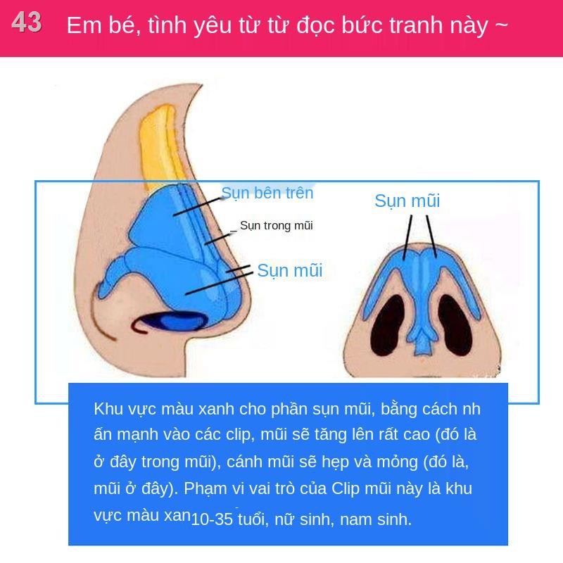 AKẹp Mũi Căng Thiết Bị Nâng Cao Cánh Hẹp Cầu Để Trở Thành Tạo Hình Xinh Đẹp Và Mắt Jiashan Gen Sao Cùng Phong Cách