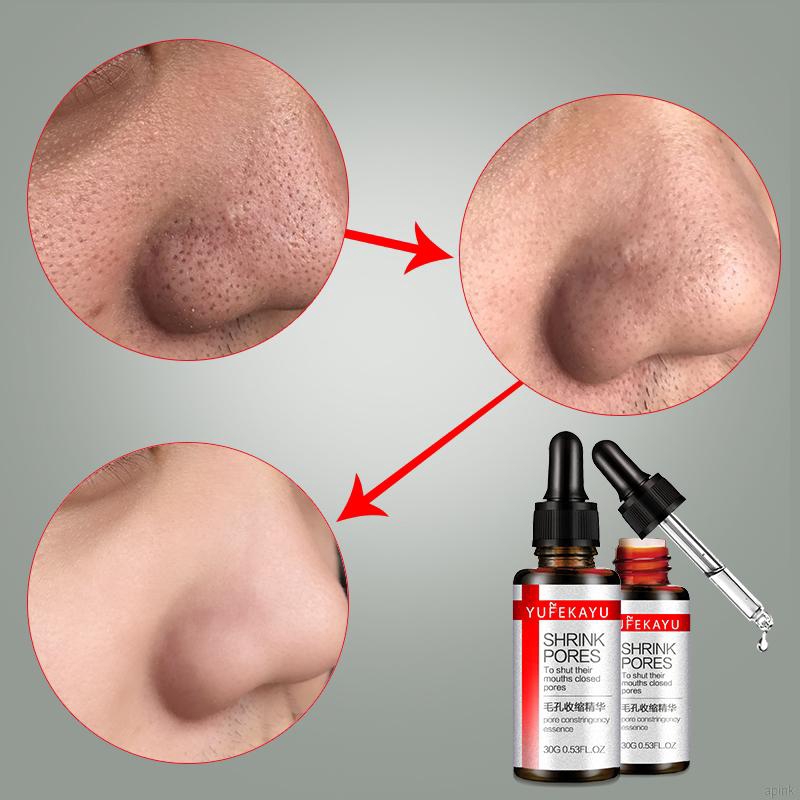 Tinh chất xóa mờ sẹo mụn/nếp nhăn thu nhỏ lỗ chân lông