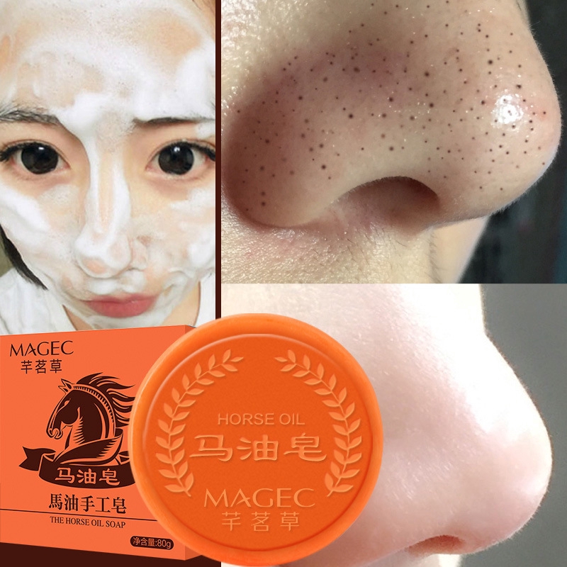 MOLAMGO  [Hàng mới về] Xà phòng tự làm loại bỏ mụn đầu đen vệ sinh sạch làn da