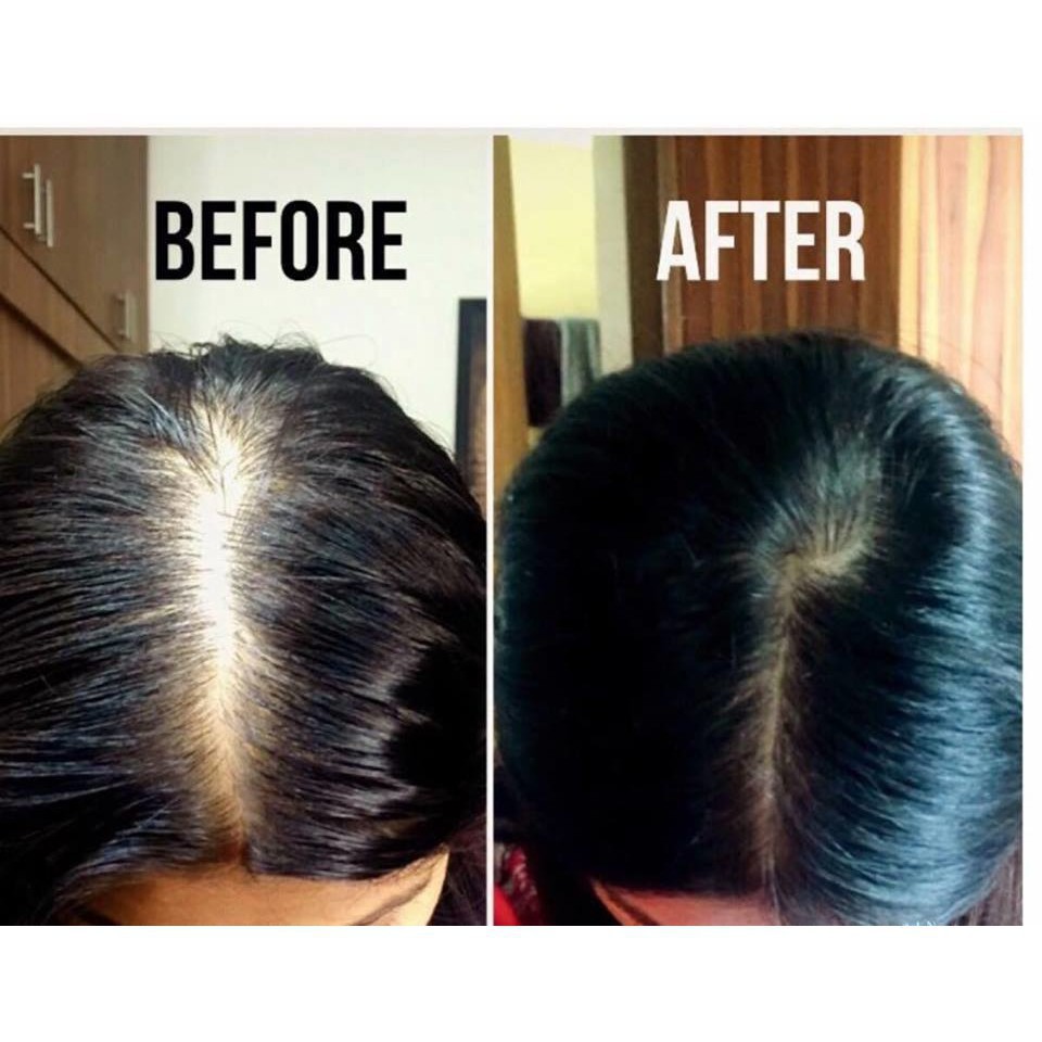 Dầu Gội Làm Sạch Và Ngăn Rụng Tóc Hiệu Quả, Làm Tóc Dày Hơn Radical Med Anti-Hair Loss Shampoo Đỏ 300ml