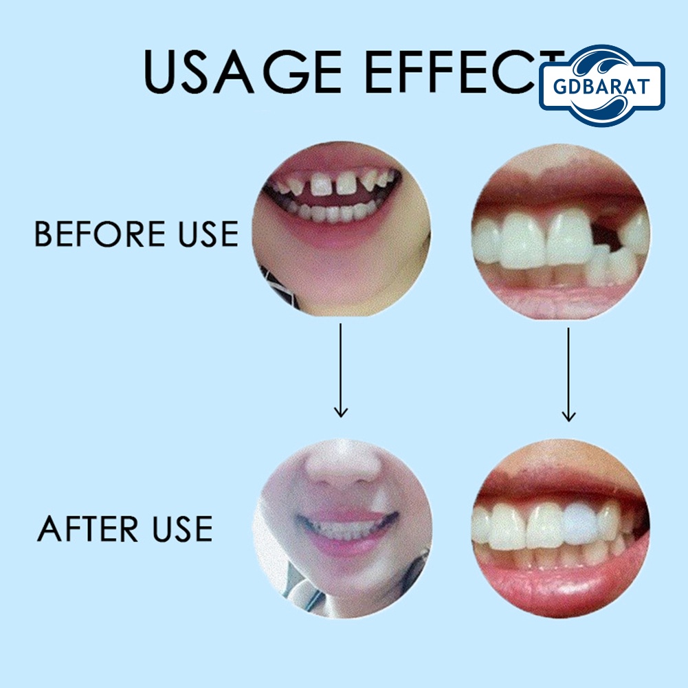 Bộ Dụng Cụ Chăm Sóc Răng Miệng Chuyên Dụng