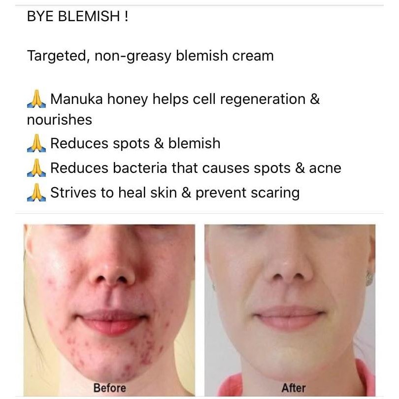 BLEMISH CREAM MANUKA DOCTOR kem ngừa, trị mụn, thúc đẩy tái tạo da và giảm thâm 25ml