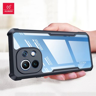 Ốp lưng Xiaomi Mi 11 cao cấp Xundd