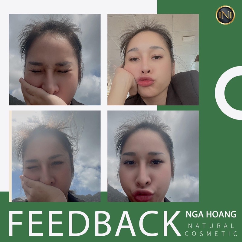 Bộ dầu gội bưởi nga hoàng 330l,dầu xả bưởi nga hoàng 330ml và xịt bưởi nga hoàng 100ml giúp tóc giảm rụng,bồng bềnh,mượt