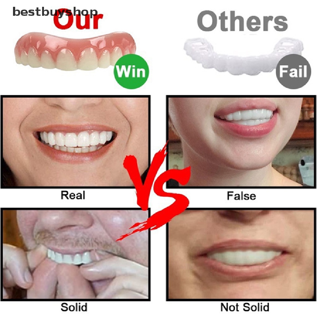 Bbvn Perfect Smile Upper Veneer In Stock Whitening Tooth Care False Teeth Denture Jelly