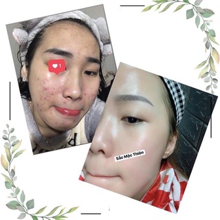 Sắc Mộc Thiên - Tái Tạo