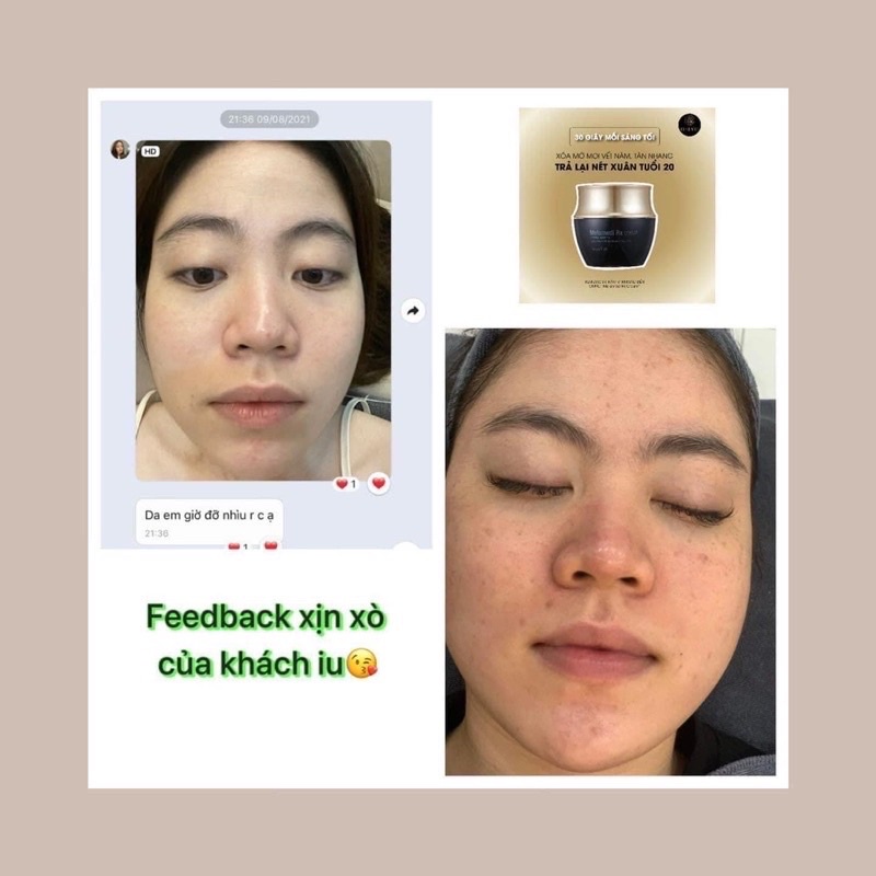 Kem Nám Melamedi Rx Cream