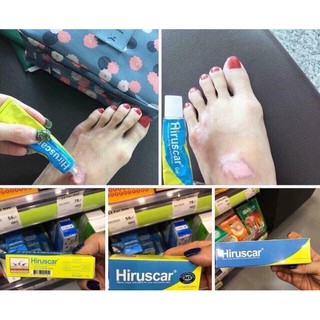 KEM XÓA SẸO HIRUSCAR THÁI LAN