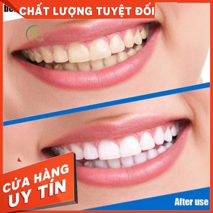 Miếng dán trắng răng Advanced Teeth Whitening Strips hiệu quả, tiện lợi. 1 hộp 14 bao 28 miếng.