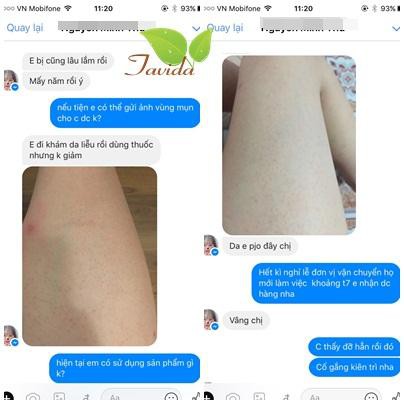 MEN VI SINH TAVIDA CHĂM SÓC LÀN DA VIÊM NANG LÔNG | BigBuy360 - bigbuy360.vn