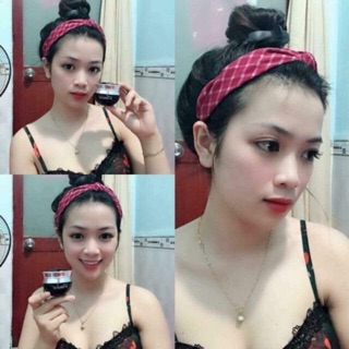 Kem face nám nhẹ swhite