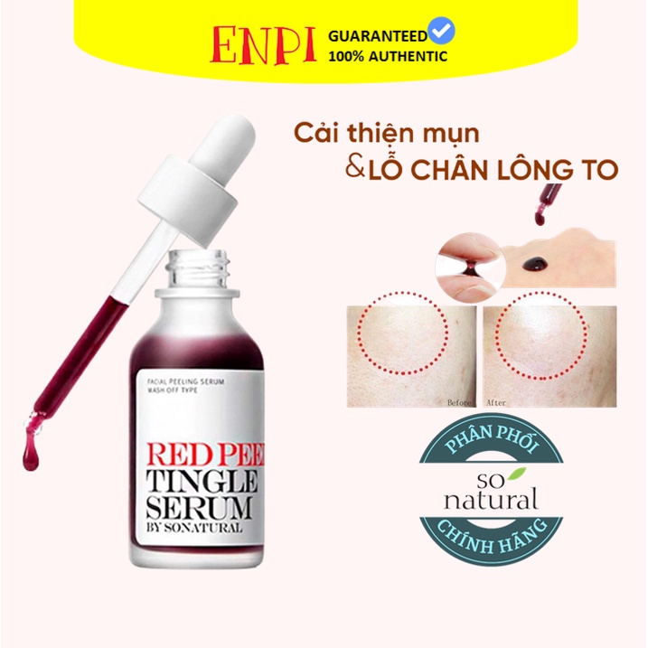 Tinh Chất Peel Da Sinh Học So’natural Red Peel Tingle Serum - 11Ml Mẫu Mới