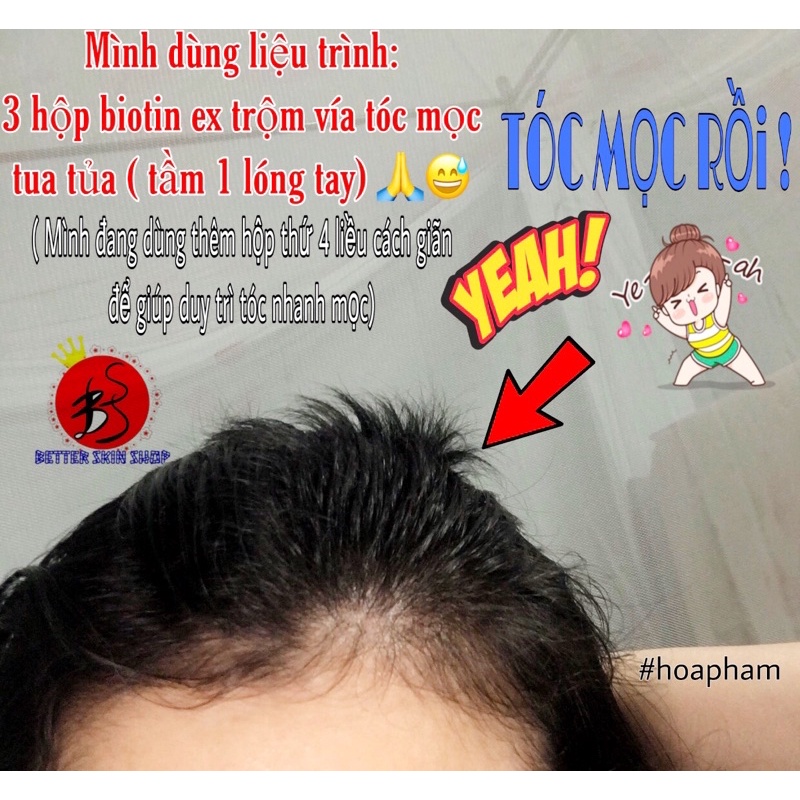 Mọc tóc Best Biotin Supplement Ex 90v Nhật Bản