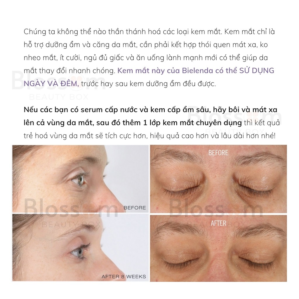 Kem dưỡng mắt BAKUCHIOL BIELENDA 15ml - BioRetinol