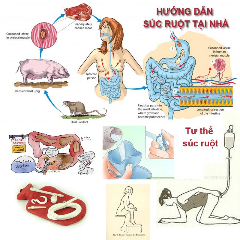 Túi Thải Độc Đại Tràng - Túi Truyền Enema - Túi Cho Ăn