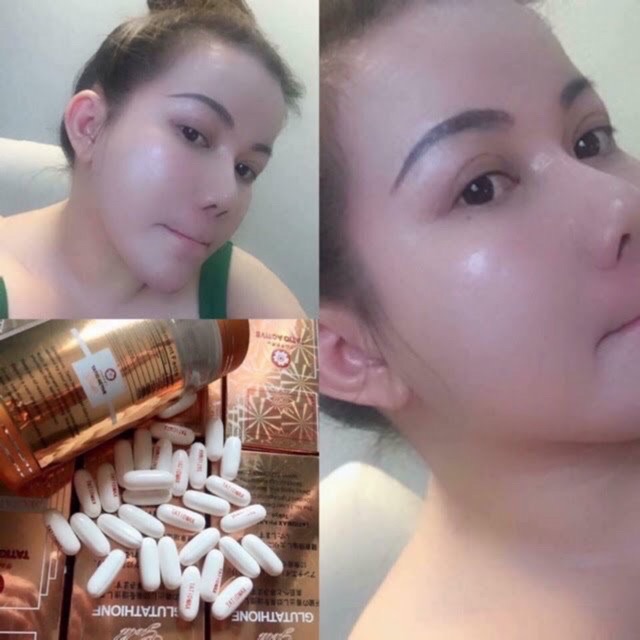 (Chuẩn Aut) Trắng da Tatio Active Gold Glutathione Nhật Bản | BigBuy360 - bigbuy360.vn