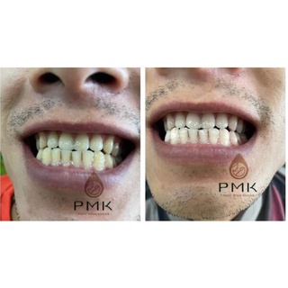 Tinh chất răng miệng Phúc Minh Khang