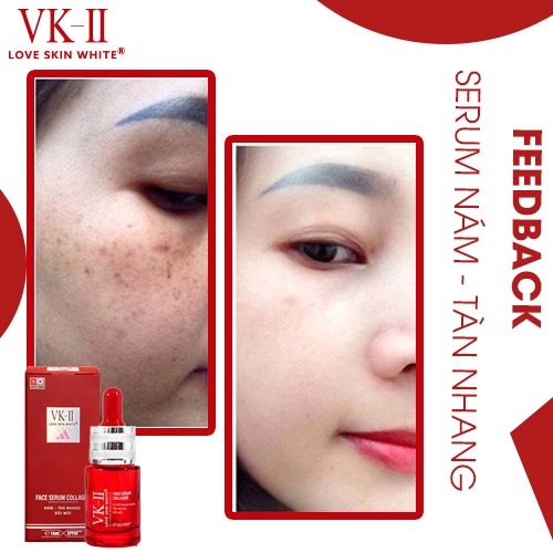 Tinh chất dưỡng da mờ nám, tàn nhang, đồi mồi VK-II Love Skin White Face Serum Collagen 15ml