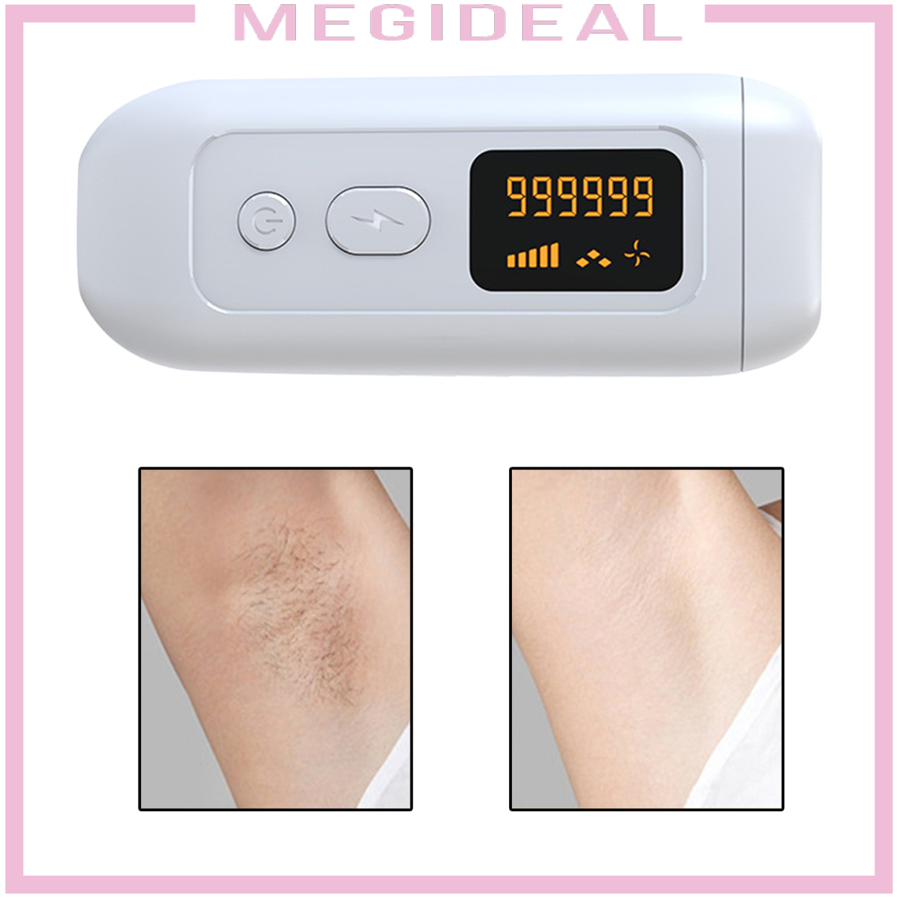 (Hàng Mới Về) Máy Cạo Lông Vĩnh Viễn Bằng Laser 990000 Flashes Phích Cắm Eu | BigBuy360 - bigbuy360.vn