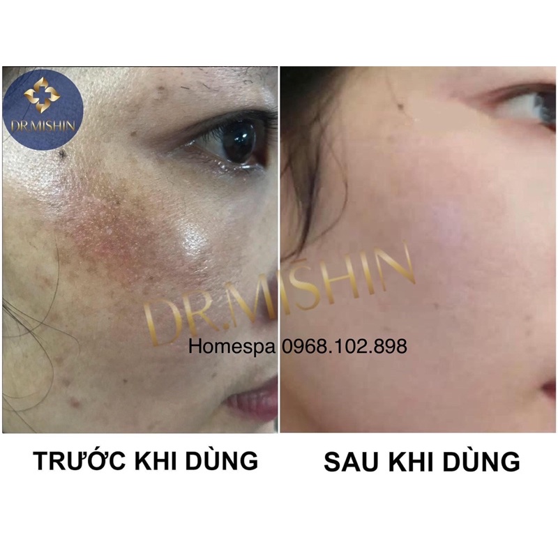 BỘ DR MISHIN dành cho da từ 25 tuổi