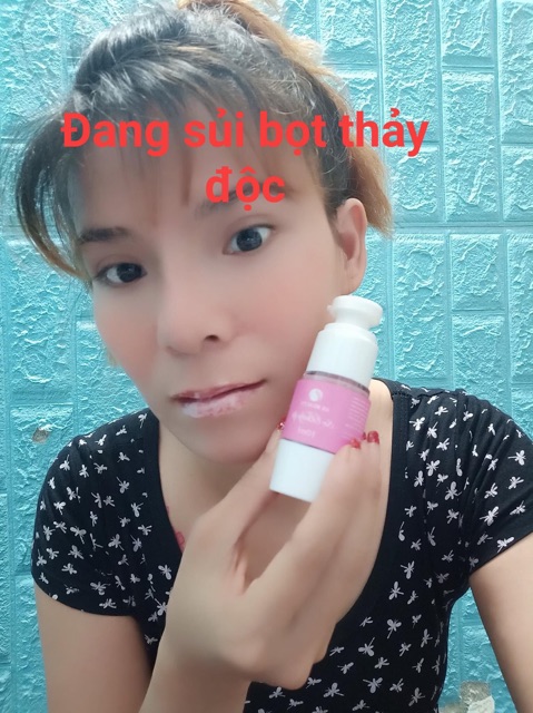 KHỬ , TẨY DA CHẾT MÔI | BigBuy360 - bigbuy360.vn
