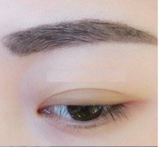 3 vỉ kích mí lưới 48 miếng/ 96m/ 192m