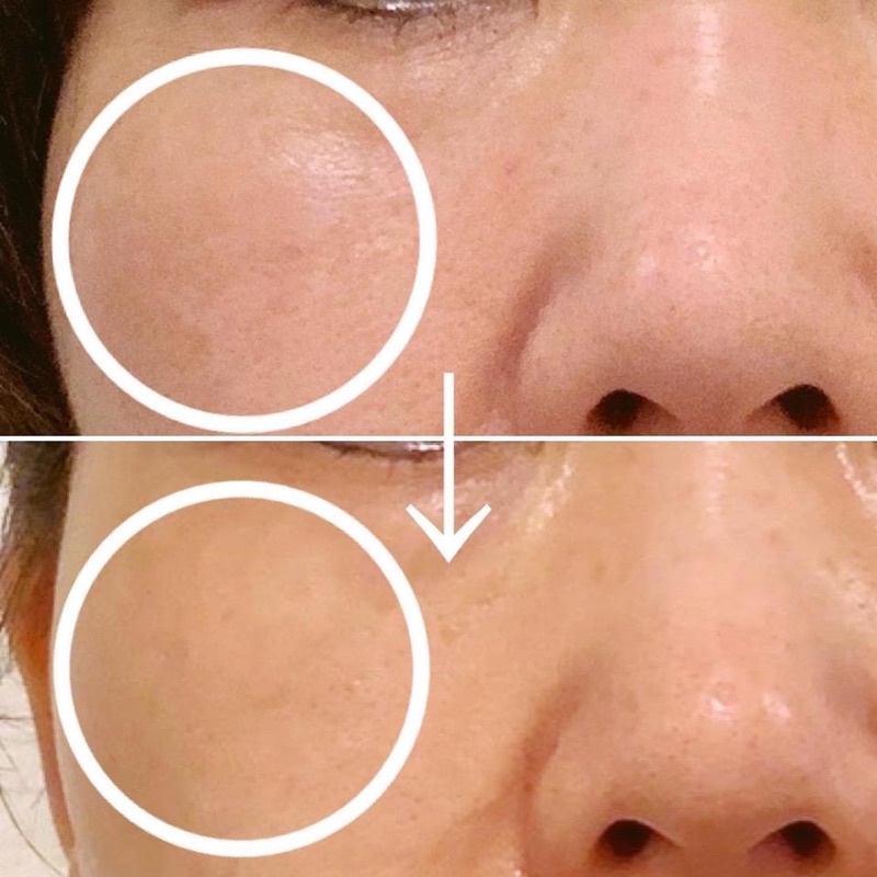 Huyết Thanh Elasto Chứa Tế Bào Gốc Chống Lão Hoá,Nâng Cơ và Làm Sáng Da