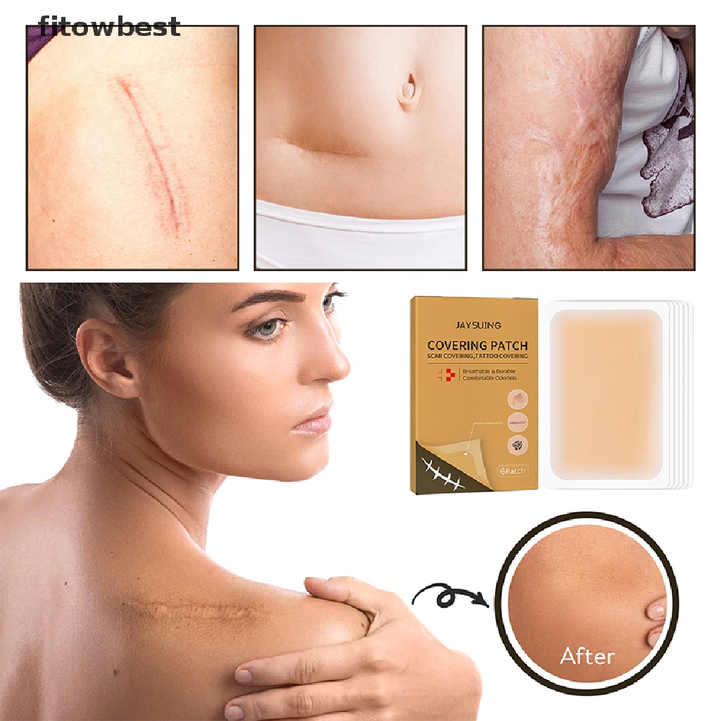 Ftvn Skin Invisible Concealer Patch Sticker Breathable Tattoo Scar Cover Waterproof QDD