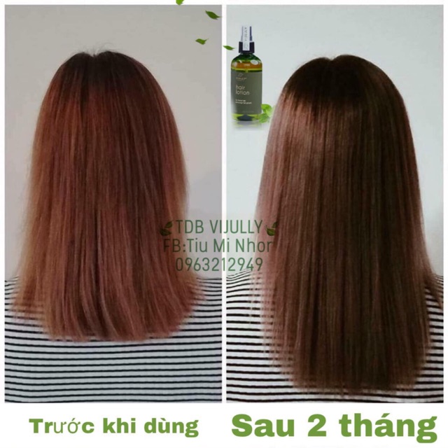 Tinh dầu bưởi trị rụng tóc-kích mọc tóc-dưỡng tóc | BigBuy360 - bigbuy360.vn