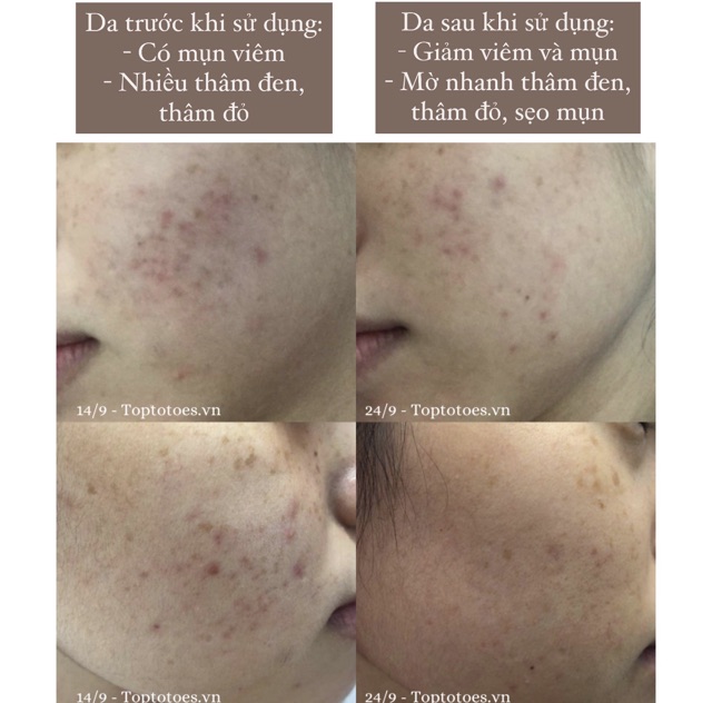 Serum Bielenda Retinol Neuro/ Mezo Skin Clinic trẻ hoá, làm da căng bóng, mờ thâm sẹo