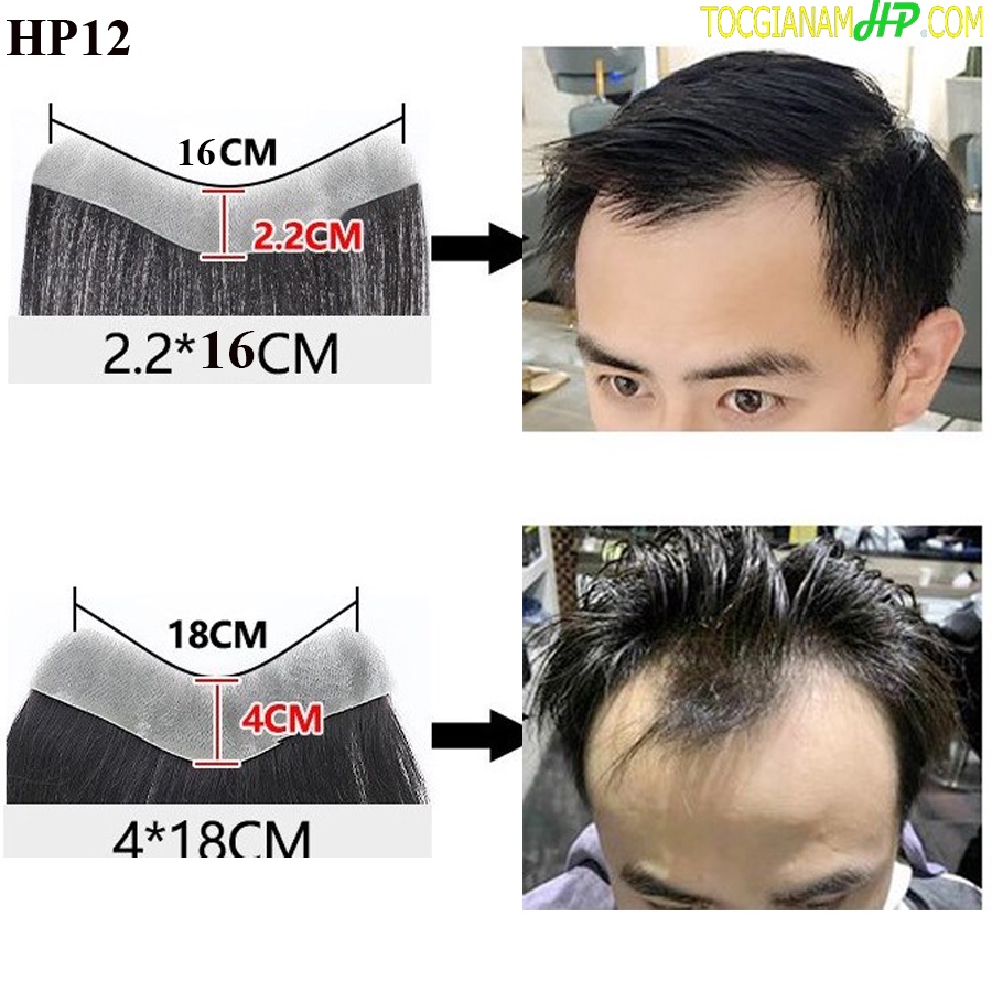 Tóc giả mái chữ M siêu da che trán cao