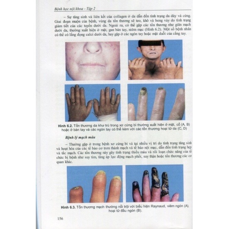 Sách - Bệnh học Nội khoa