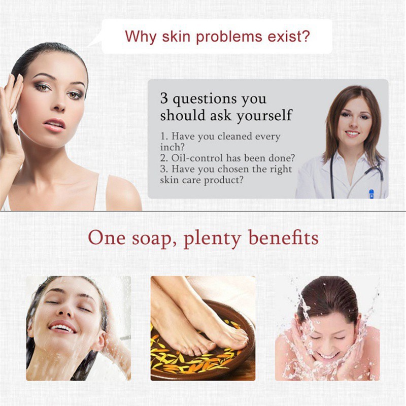 1 Xà Phòng Lưu Huỳnh ZUDAIFU Làm Sạch Lỗ Chân Lông Và Loại Bỏ Mụn Trứng Cá