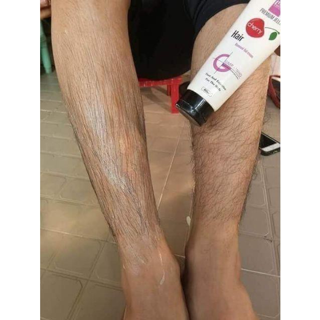 Triệt lông Mwhite | BigBuy360 - bigbuy360.vn