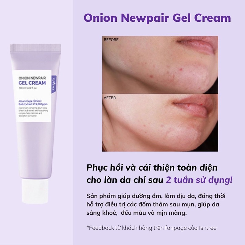 Dòng sản phẩm sáng da mờ thâm Onion newpair gel cream/ Toner essence/ Cleansing foam