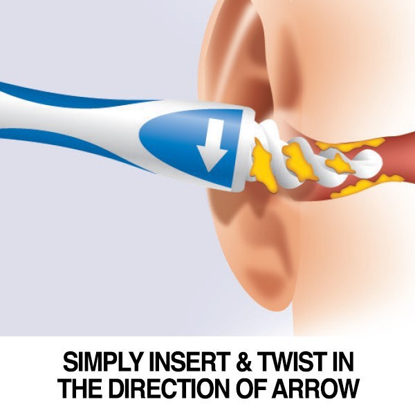 Dụng cụ lấy ráy tai thông minh Smart Swab - TR2944 - BX1912