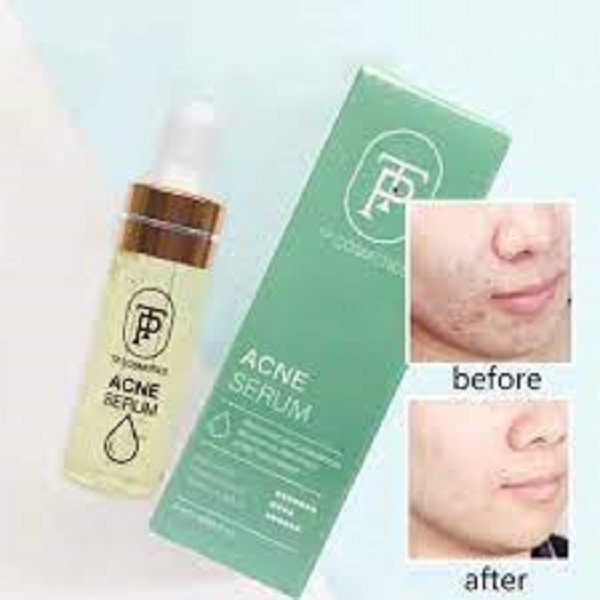 [chính hãng] serum giảm mụn hiệu quả sau 3 ngày sử dụng