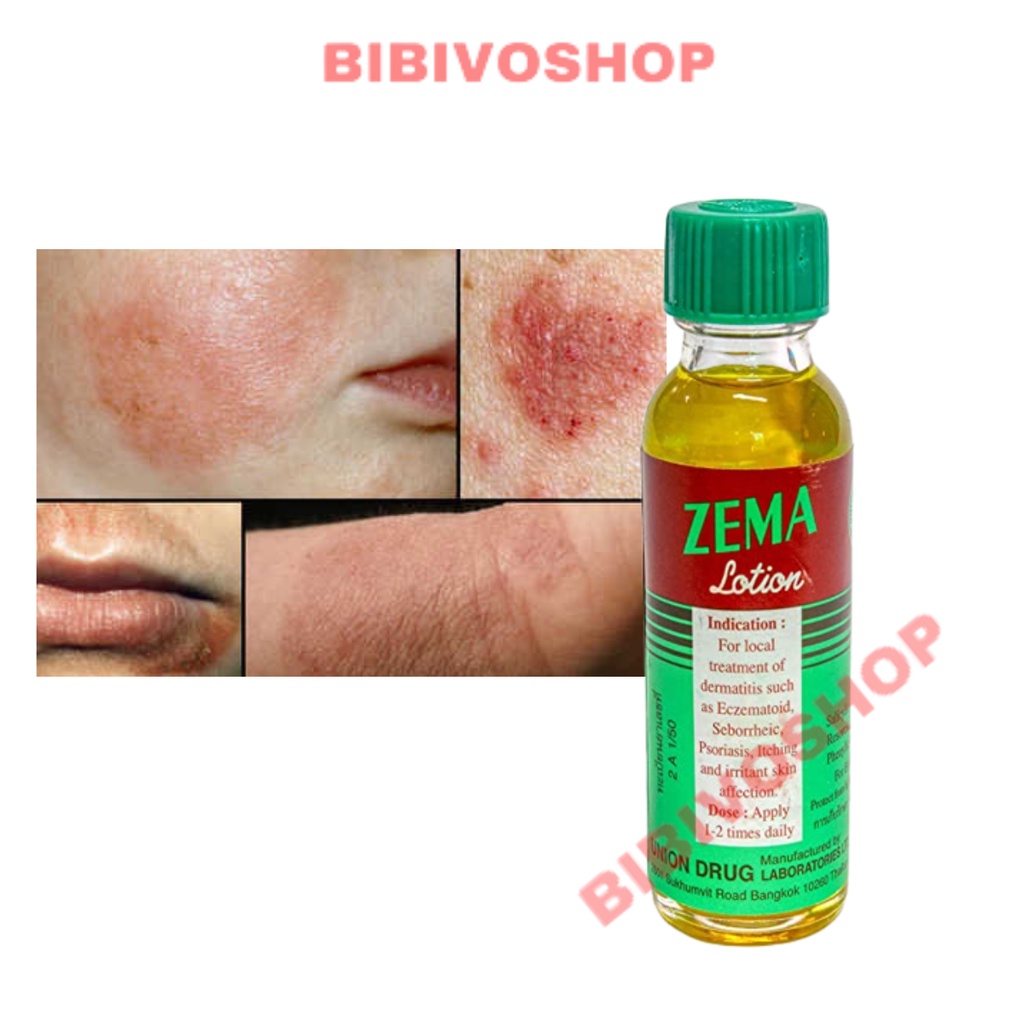 Zema Lotion 15ml, Thái Lan