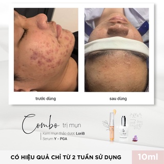 Kem mụn LoriB 10ml